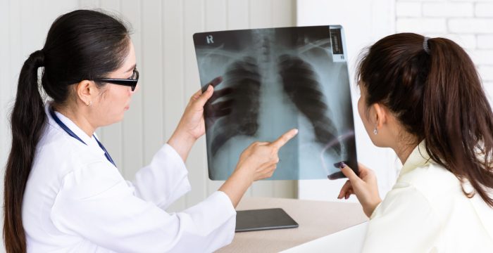 Medical doctor give consultation to patient with x-ray film